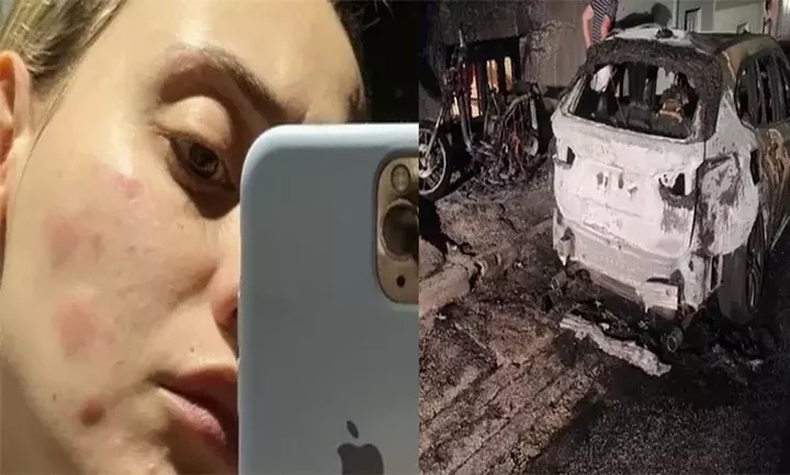 Άννα Κορακάκη: Σοκάρουν οι φωτογραφίες που ανέβασε - «Stalker» της έκανε τη ζωή κόλαση